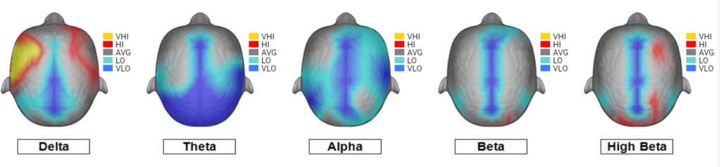 Example 2 of post Huachuma brain map