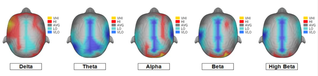 Example 3 of post Huachuma brain map