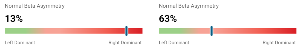 improvement in the high amplitude alpha